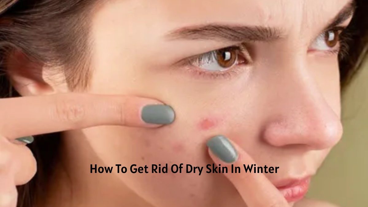 How To Get Rid Of Dry Skin In Winter