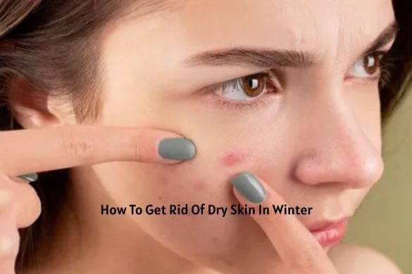 How To Get Rid Of Dry Skin In Winter