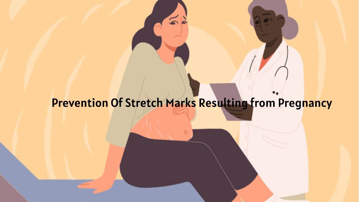 Prevention Of Stretch Marks Resulting from Pregnancy