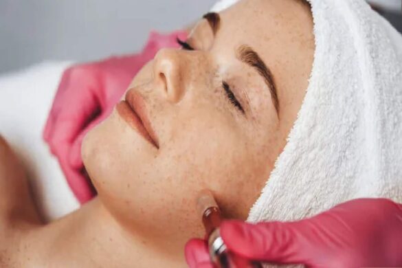 What is Collagen Stimulation Therapy?