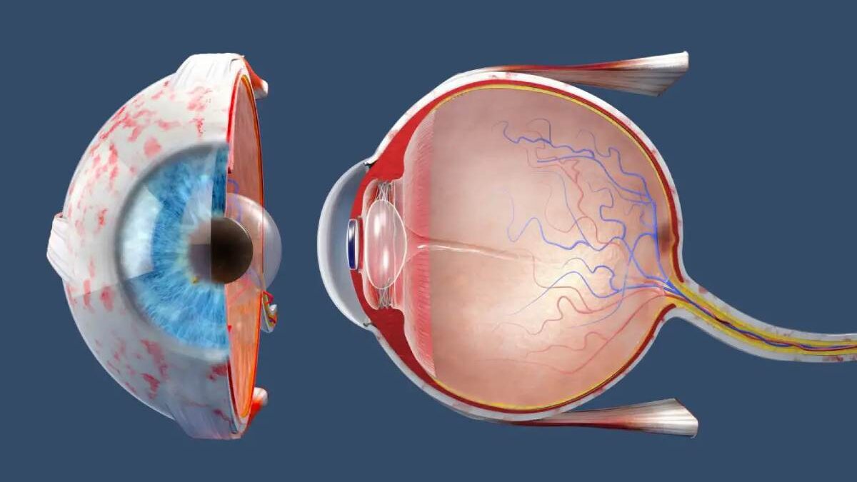 Why do scientists fear an increase in myopia?